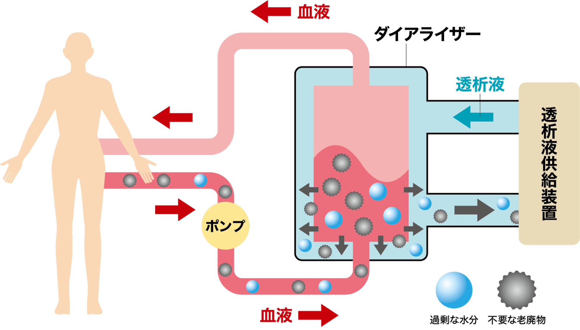 血液透析