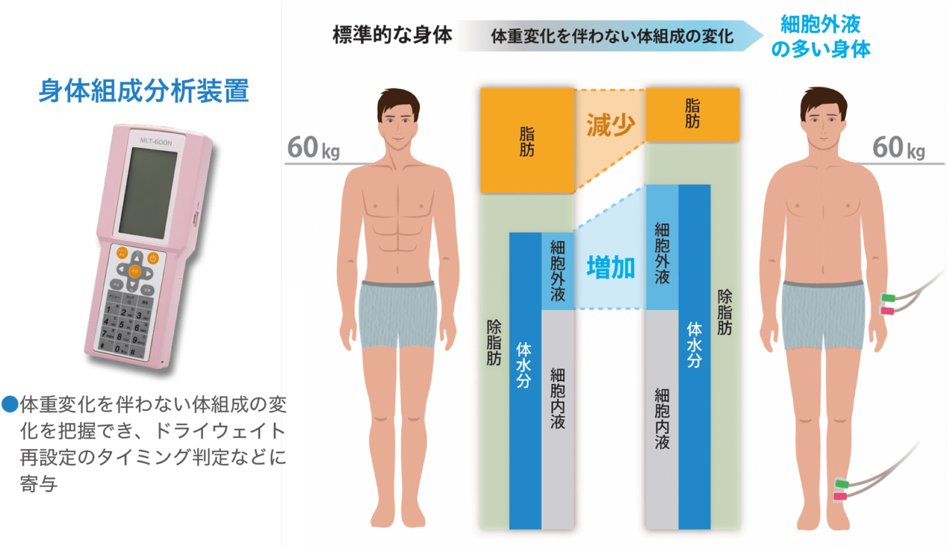 血液透析
